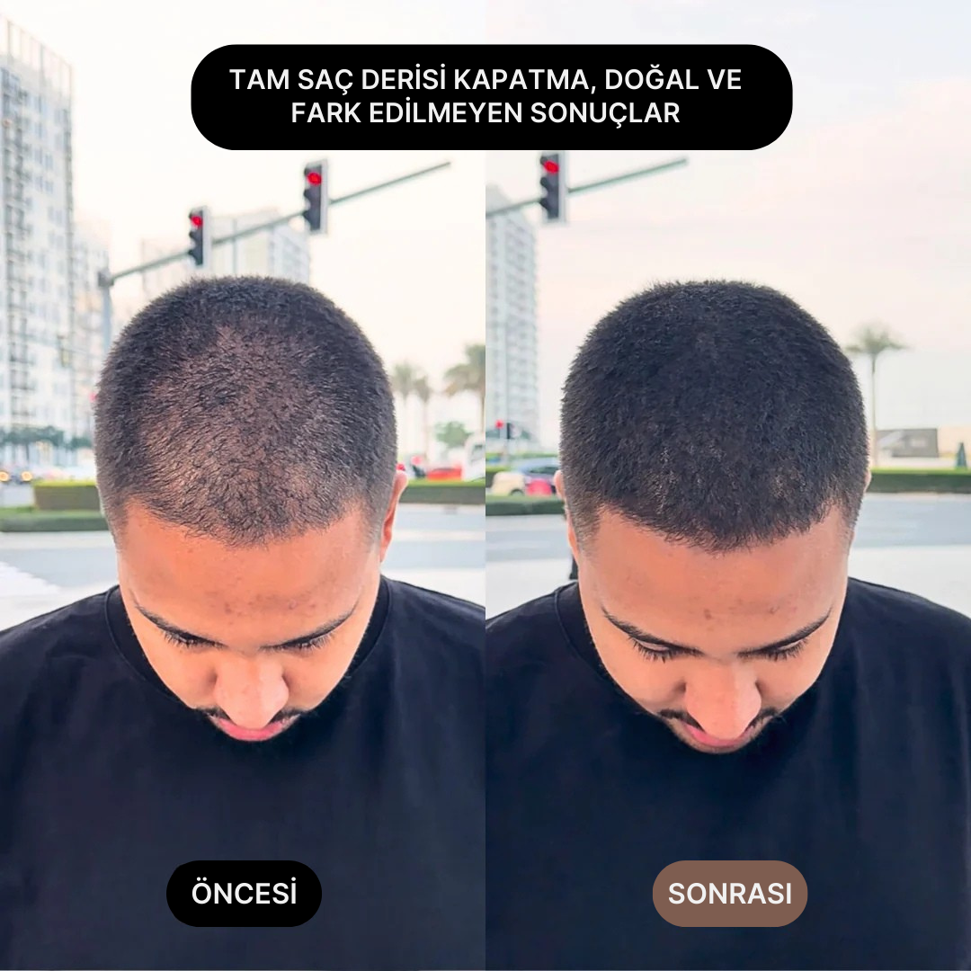 Su geçirmez saç kapatıcı öncesi ve sonrası görüntü, doğal görünüm ve fark edilmeyen sonuçlar.