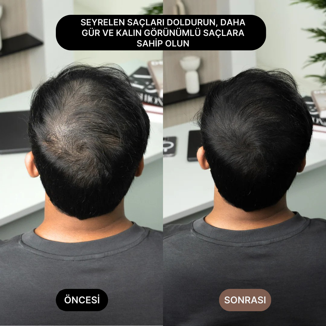 Önce ve sonra karşılaştırması ile seyrek saçları doldurarak daha kalın görünüm sağlayan saç kapatıcı